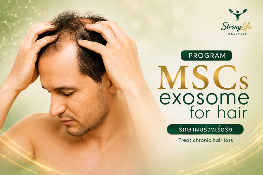 Program MSCs for Exosome for hair