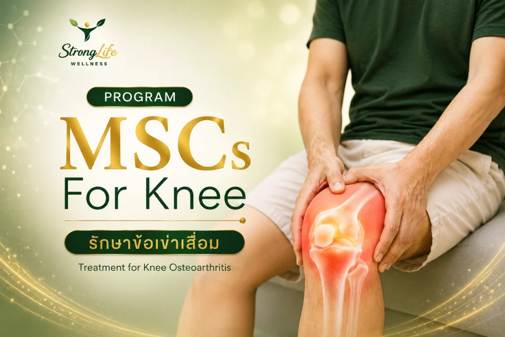Program MSCs for Knee